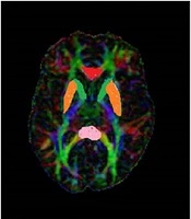 Arch Neurosci